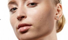 徒手祛斑爆料视频教程图片,跟随视频教程轻松告别斑点困扰